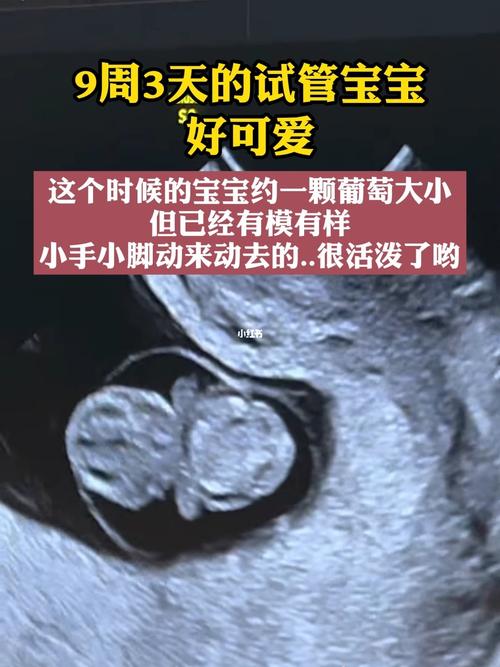 试管助孕代生宝宝舌苔厚是什么原因